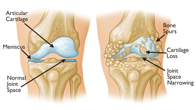 Knee dislocations